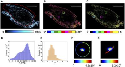 Whole-Section Tumor Micro-Architecture Analysis by a Two-Dimensional Phasor-Based Approach Applied to Polarization-Dependent Second Harmonic Imaging